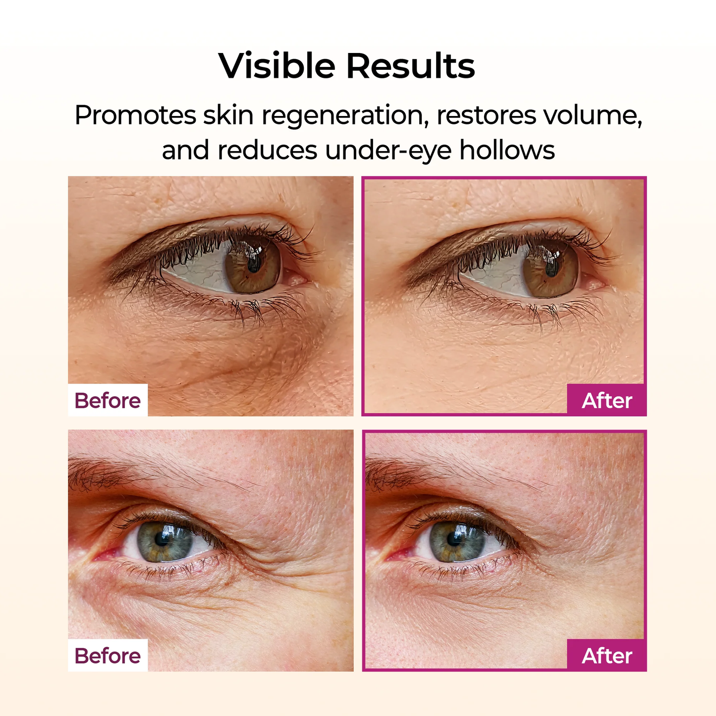 🏆 #1 Bestselling🏆 💫 Anti-Aging & Firming Skincare Stick